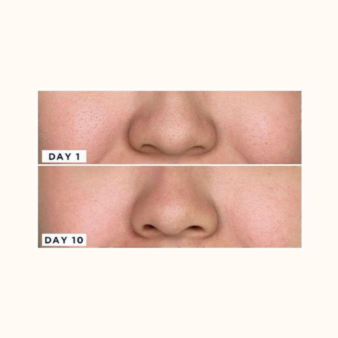 CosrxTwo in One Poreless Power Liquid