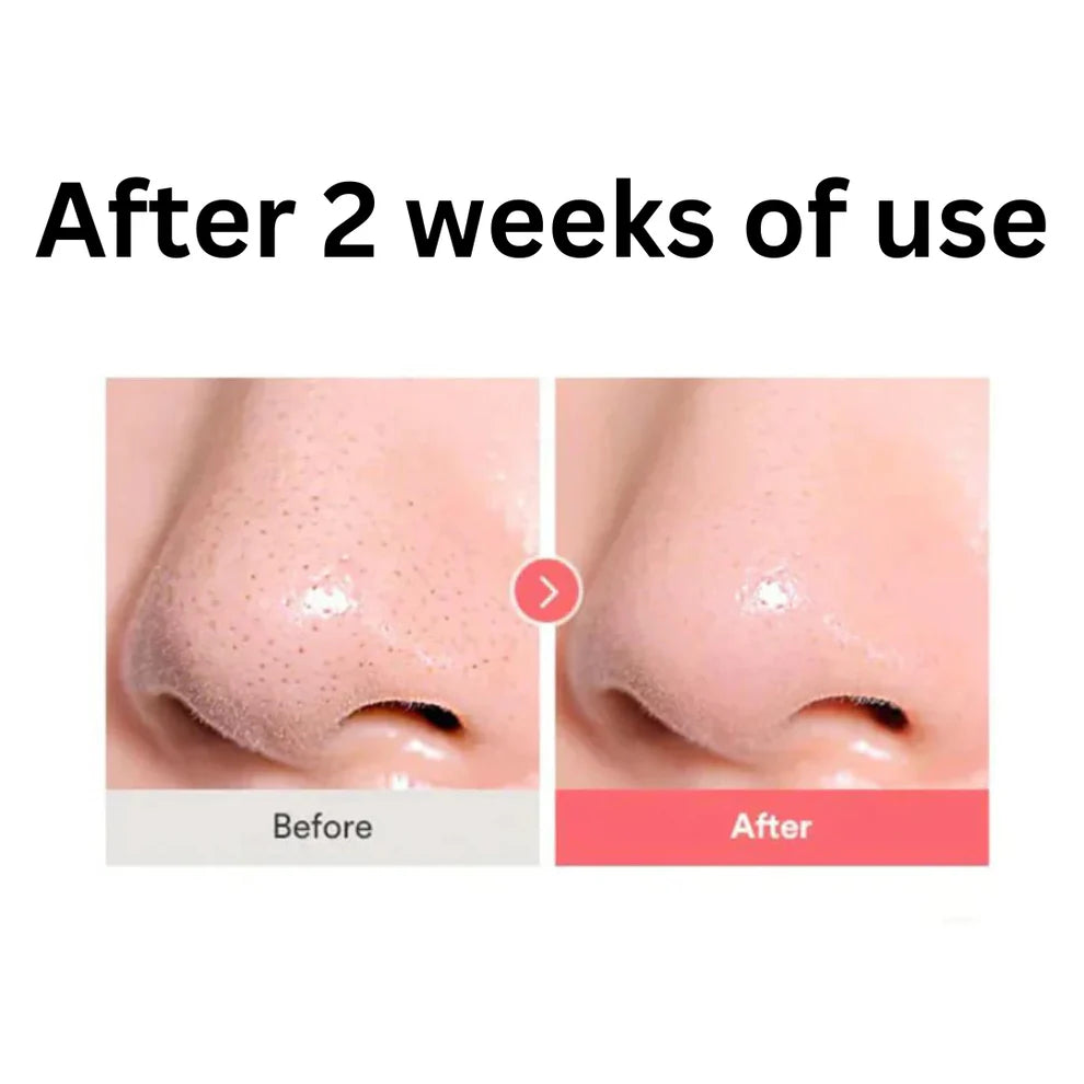 Tocobo Calamine Pore Control Cleansing Oil