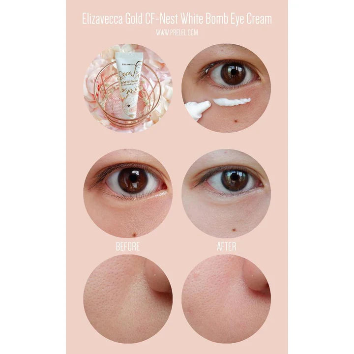 Elizavecca Gold CF-Nest White Bomb Eye Cream 30ml