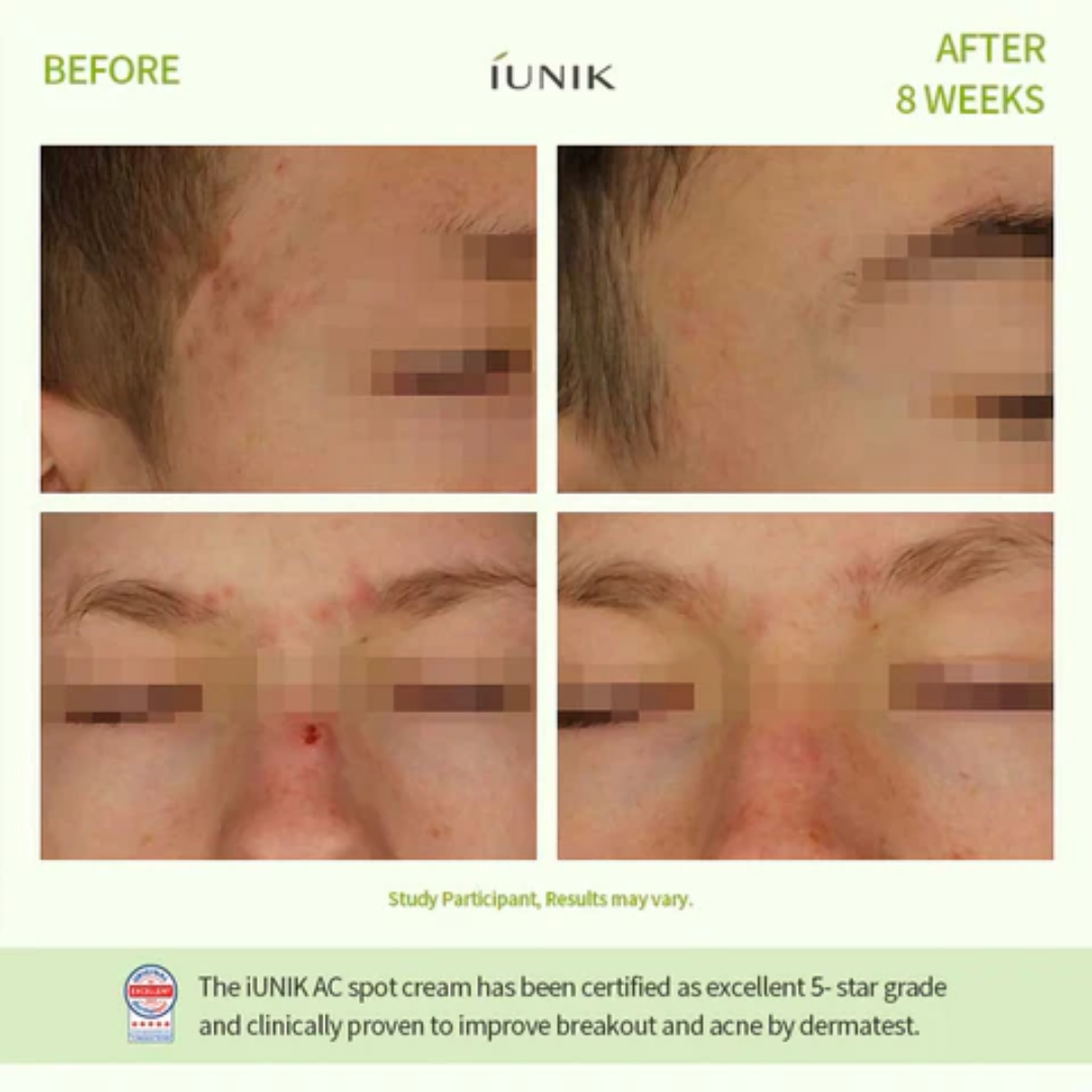 iUnik Centella Calming AC Spot Cream