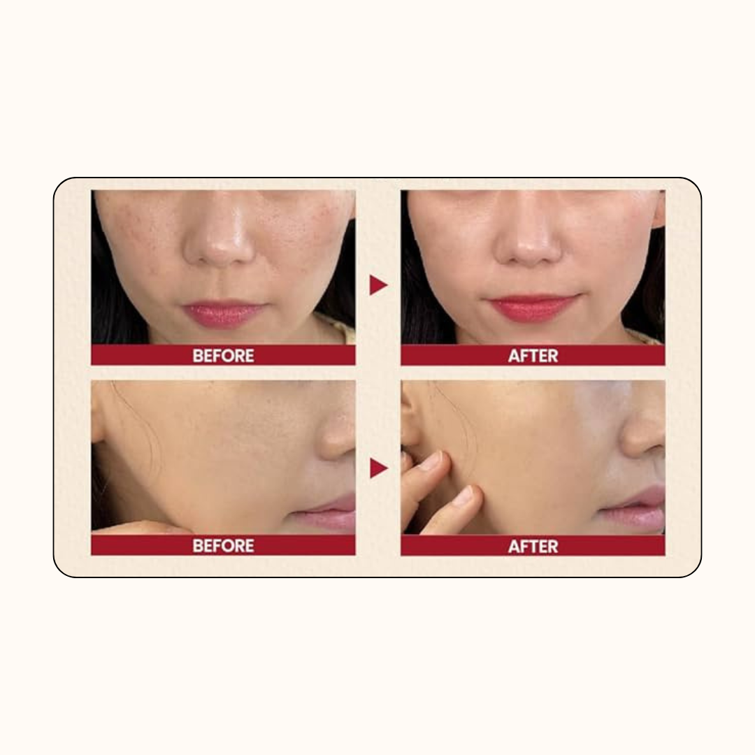 Ksecret Seoul 1988 Essence : Snail Mucin 97% + Rice 100ml