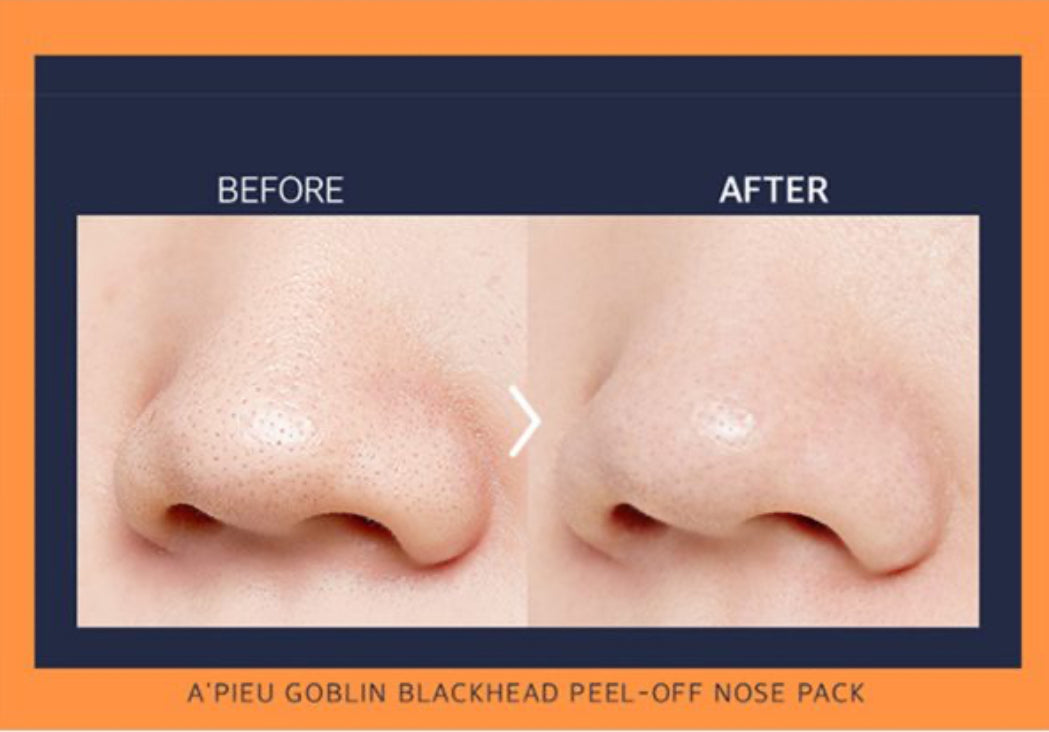 A’pieu Goblin Blackhead 3-Step Nose Pack