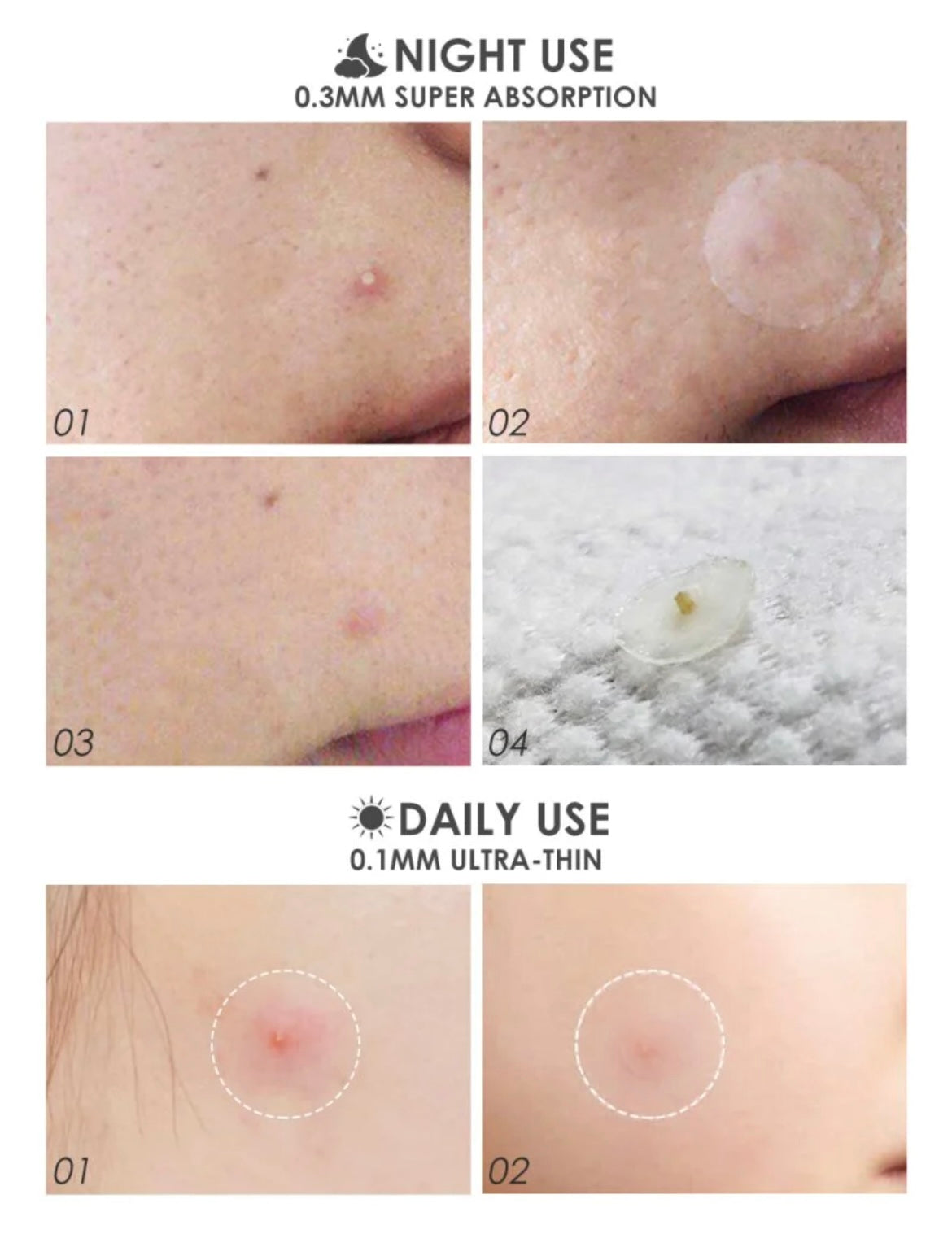 Focallure Acne Pimple Patch Night Day & Night