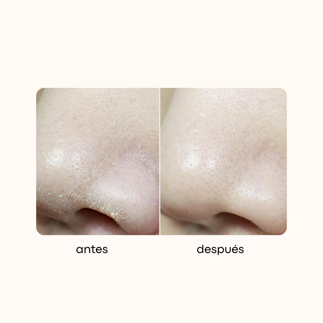 medicube Zero Foam Cleanser