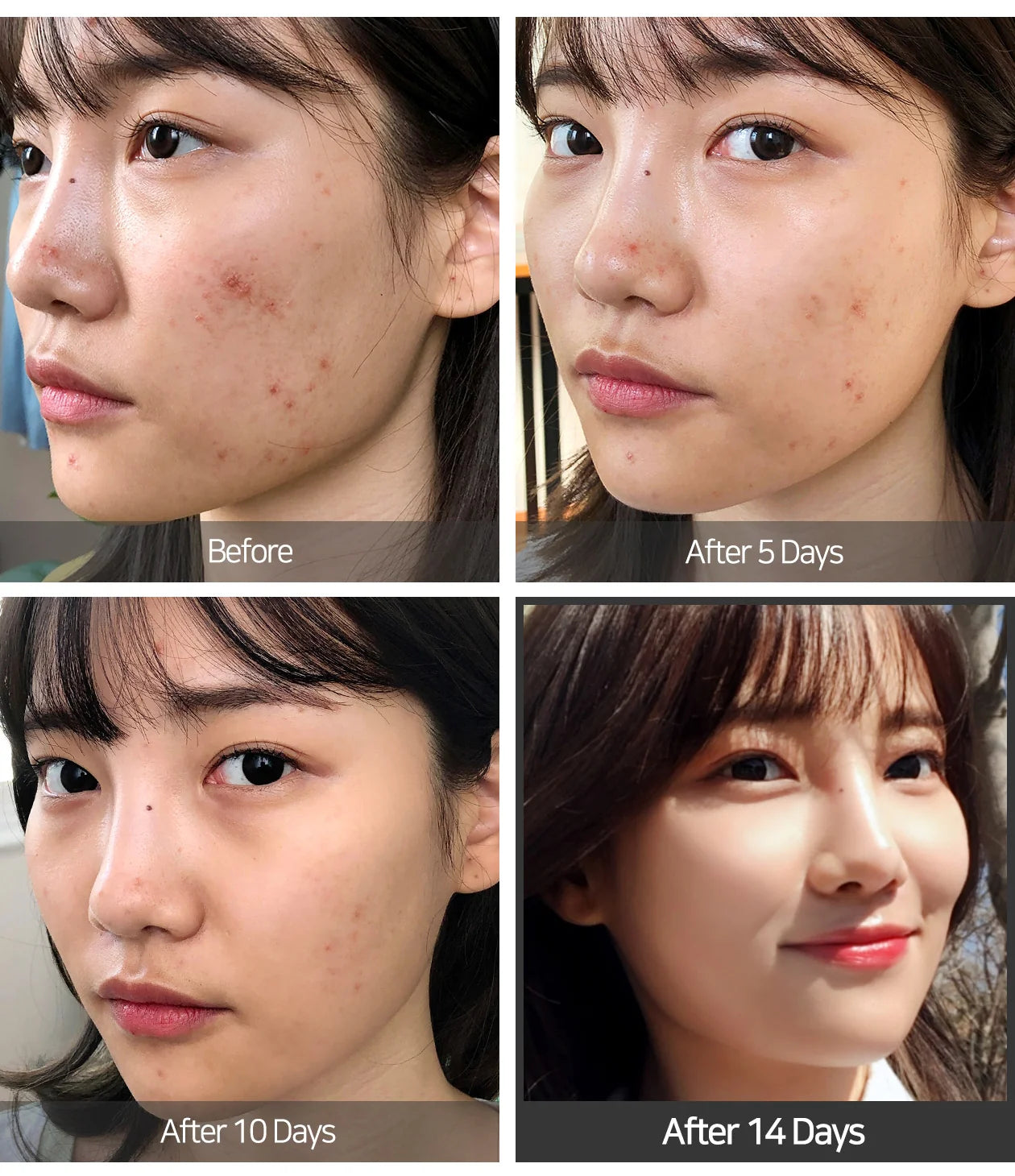 Some By Mi AHA/BHA/PHA 14 Days Super Miracle Spot All Kill Cream