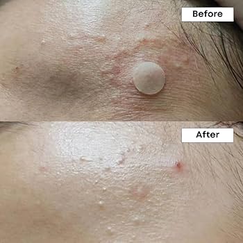 Nineless A Control 10% Azelaic Acid Serum