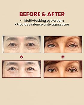 Ksecret Seoul 1988 Eye Cream: Retinal Liposome 4% + Fermented Bean