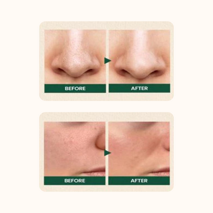 Ksecret Seoul 1988 Cleansing Foam : Pine Cica 1% + Probiotics