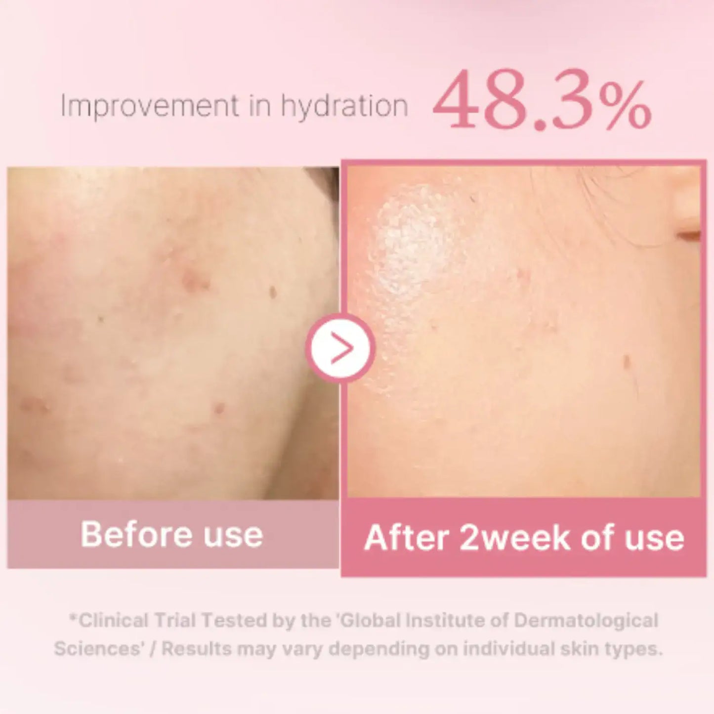 Medicube PDRN Pink Niacinamide Milky Toner