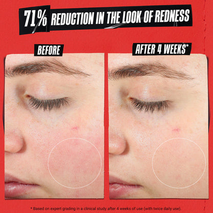 Mini Ultra Facial Meltdown Recovery Medicated Cream with Colloidal Oatmeal